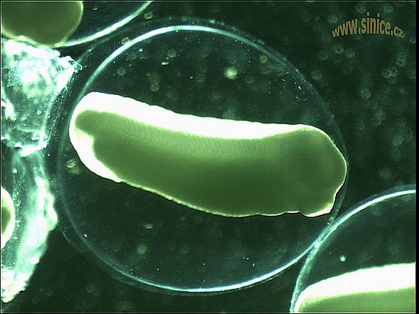 Xenopus laevis - embryo